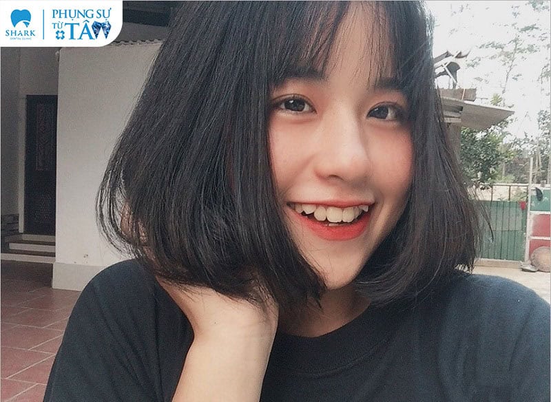 Ảnh gái xinh răng khểnh cute đáng yêu